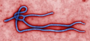 http://upload.wikimedia.org/wikipedia/commons/e/e6/Ebola_virus_virion.jpg